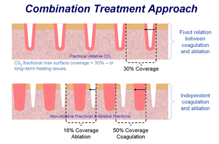 facial rejuvenation